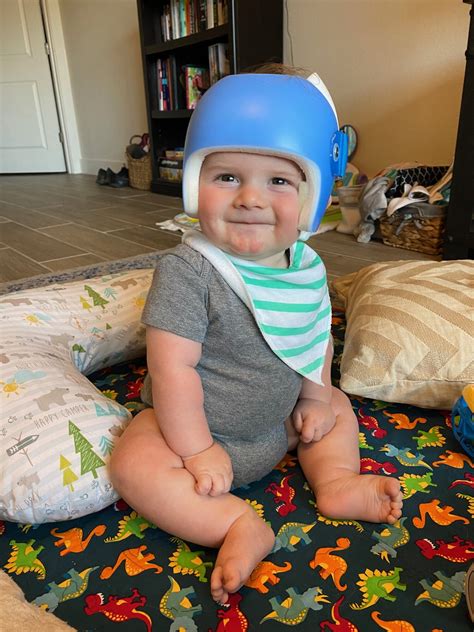 Our son wore it a month before he outgrew it (this is very unusual), got a second one but his skin couldn't take it anymore so we ended it (he has pretty bad eczema). . Baby helmet therapy cost